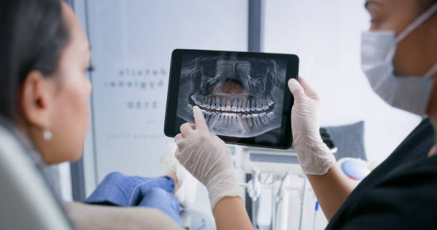 Licensed Tooth Extraction service in San Martin, CA - Smile Center Dentistry